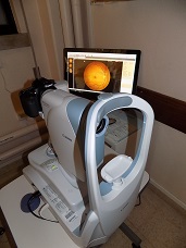 Oftalmologia retinografo novo agosto17 1